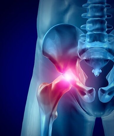ból biodra zdjęcie 1
