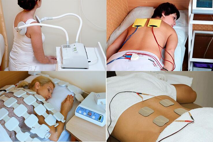 metody fizjoterapeutyczne