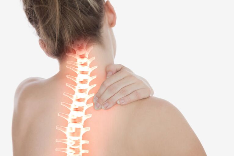 osteochondroza odcinka szyjnego kręgosłupa